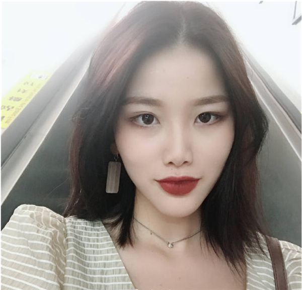 小姐姐的耳软骨隆鼻案例分享连载(三)