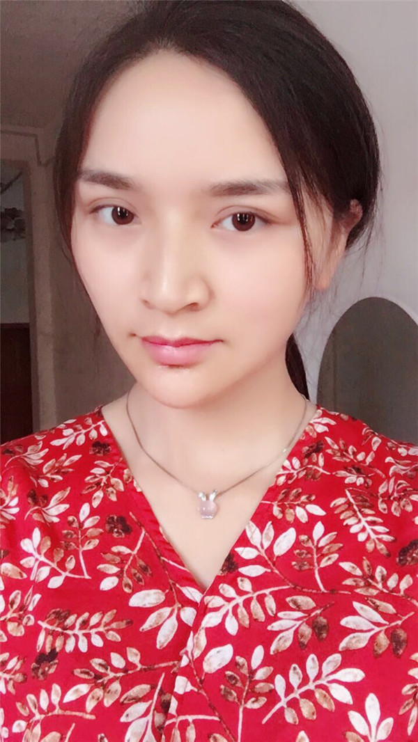 武汉洪山爱美瞿敏硅胶垫下巴案例分享附下巴整形多少钱?