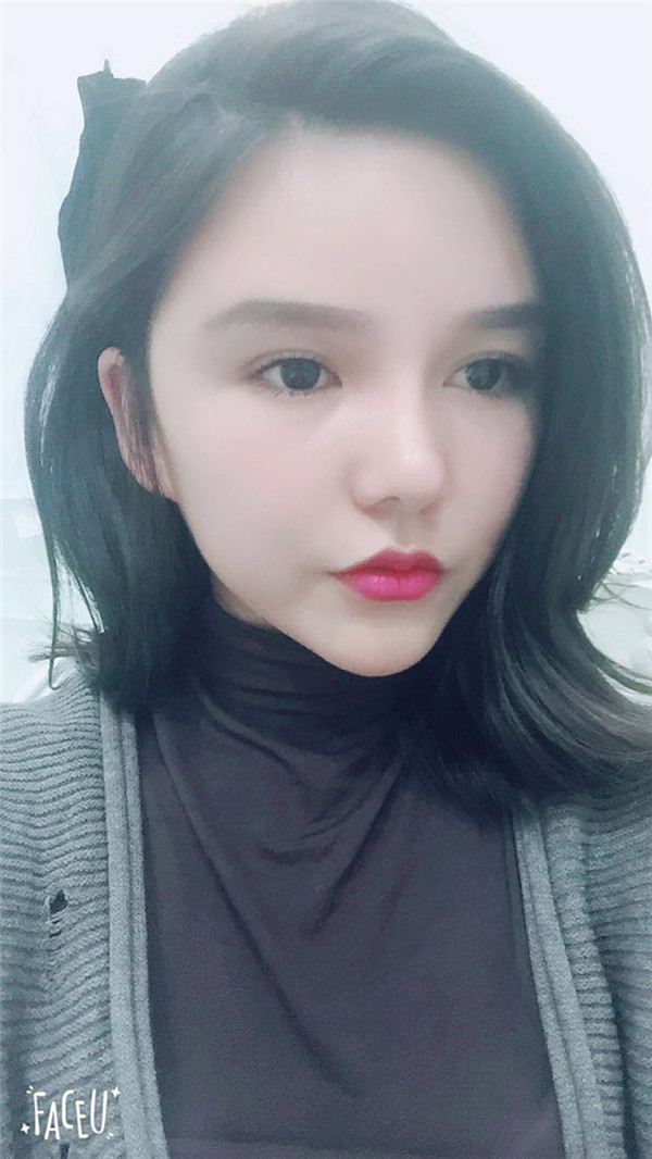 郑州华领张永涛自体脂肪全脸填充案例分享附自体脂肪填充法改善法令纹好吗?