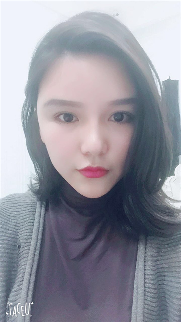 郑州华领张永涛自体脂肪全脸填充案例分享附自体脂肪填充法改善法令纹好吗?