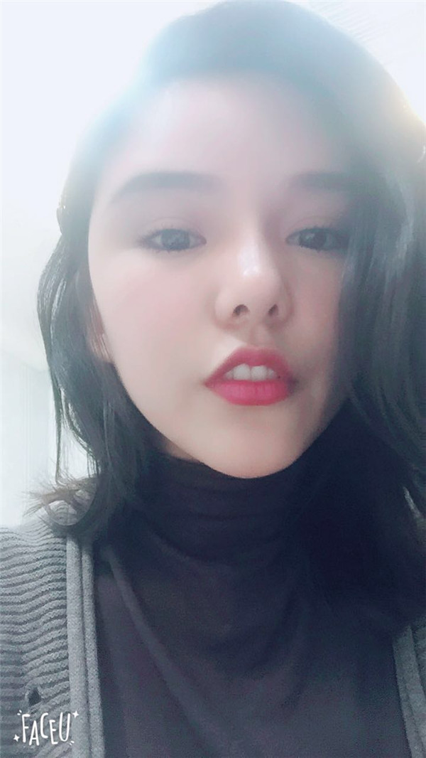 郑州华领张永涛自体脂肪全脸填充案例分享附自体脂肪填充法改善法令纹好吗?