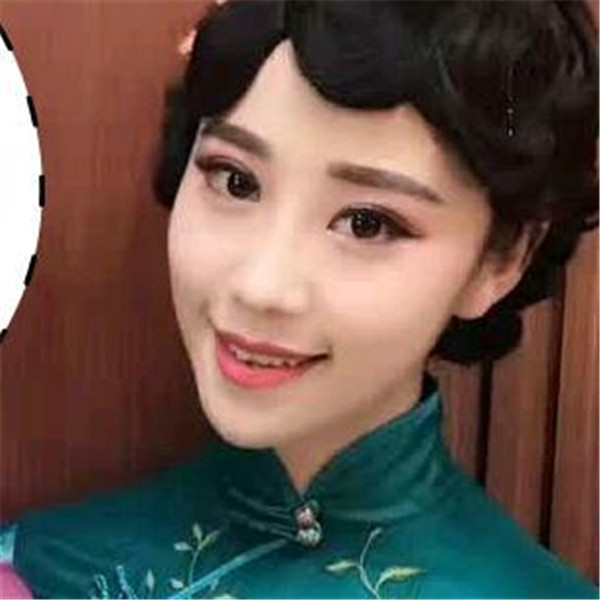 国庆归来,你"脱单"了吗?!双眼皮案例连载(三)