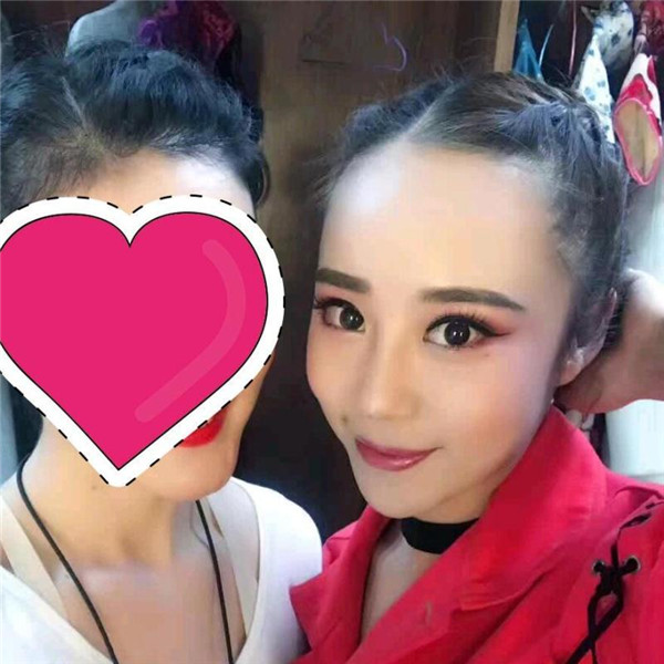 国庆归来,你"脱单"了吗?!双眼皮案例连载(三)