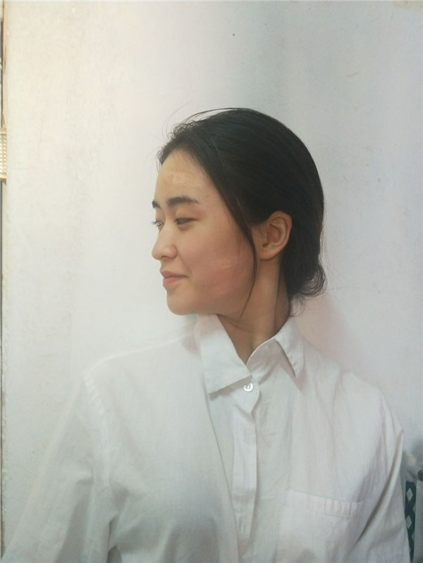 双十一临近你变美了吗?面部填充连载(一)