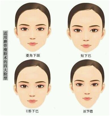 上海时光何晋龙磨骨改脸型怎么样?价格案例分享