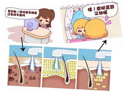 济南艺星光子嫩肤怎么样?价格案例分享
