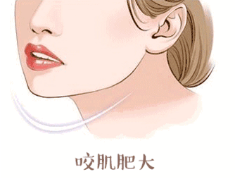 广州曙光打注射瘦脸怎么样?价格案例分享