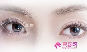 成都军大割双眼皮怎么样?价格案例分享
