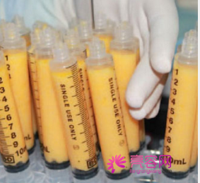 北京丽都自体脂肪填充怎么样?价格案例分享