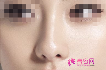 四川成都娇点隆鼻怎么样?价格案例分享
