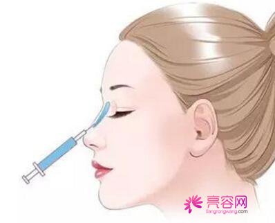 广州紫馨隆鼻怎么样?价格案例分享