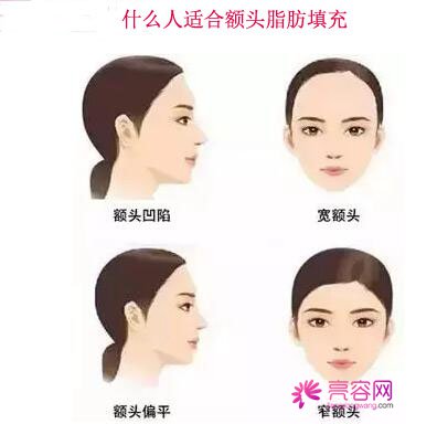 南昌鹏爱自体脂肪填充怎么样?价格案例分享