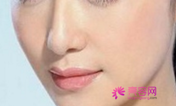 西安画美隆鼻怎么样?价格案例分享