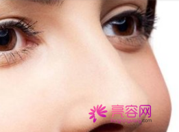 成都铜雀台隆鼻怎么样?价格案例分享