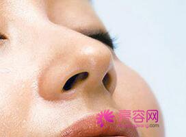 北京柏丽李劲良隆鼻怎么样?价格案例分享