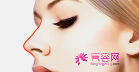 深圳蒳美迩朱灿隆鼻怎么样?价格案例分享