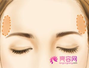 深圳金丽朱冠峰自体脂肪填充怎么样?价格案例分享
