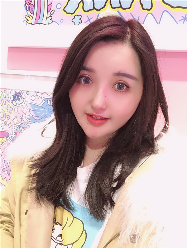 从今天往后,我也是拥有高鼻梁的人了,特别期待恢复后鼻子变好看的样子~~