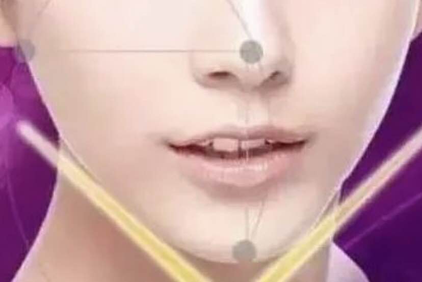 磨骨手术危险吗?能做到什么果?