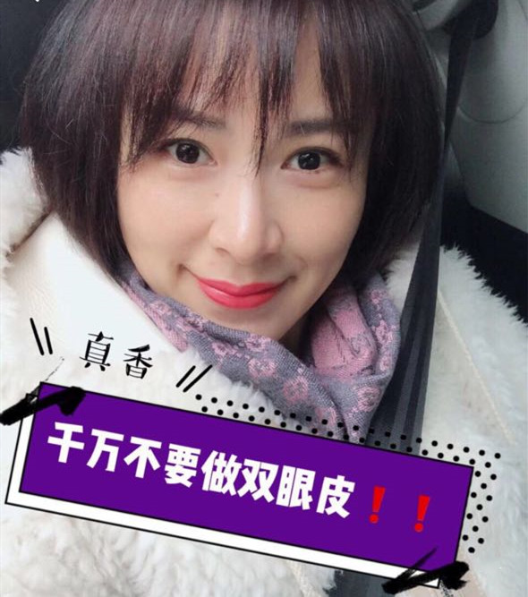 北京壹加壹张绿峰做的双眼皮
