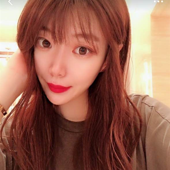 深圳美莱做双眼皮怎么样?美莱做的微创双眼皮