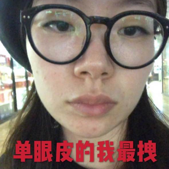 深圳美莱做双眼皮怎么样?美莱做的微创双眼皮