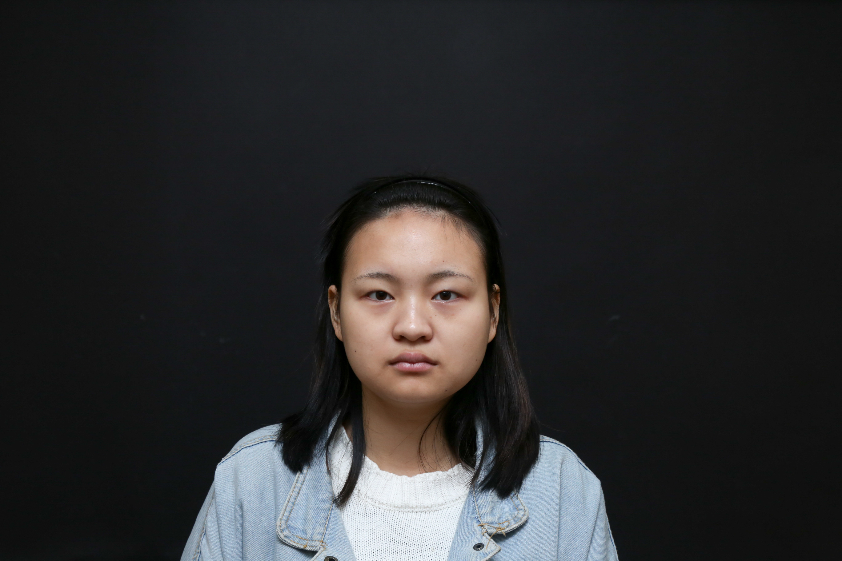 武汉美基元怎么样？眼部综合案例分享。
