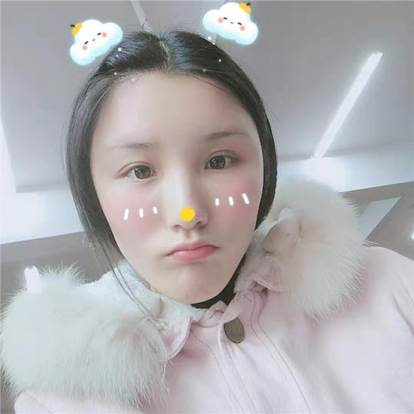 郑州华山胡斌自体脂肪全脸填充案例分享,价格,术后脸确实丰满圆润了许多,再也不是尖嘴猴腮了,哈哈哈哈~~~