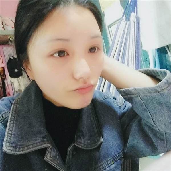 郑州华山胡斌自体脂肪全脸填充案例分享,价格,术后脸确实丰满圆润了许多,再也不是尖嘴猴腮了,哈哈哈哈~~~