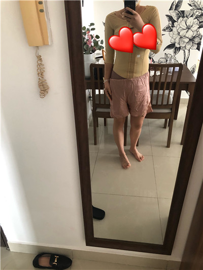 深圳美芮医疗美容王权吸脂瘦腰案例价格分享,年纪大肉松减不掉终于找到了解决方法。