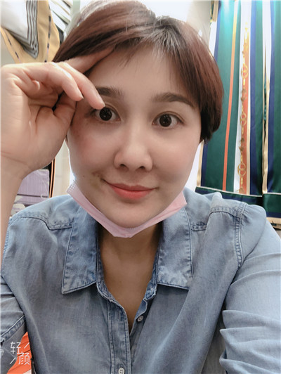 深圳美芮医疗美容王权吸脂瘦腰案例价格分享,年纪大肉松减不掉终于找到了解决方法。