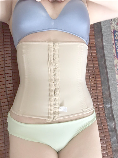合肥崔劲松医疗美容崔向葵吸脂瘦腰腹案例价格分享,胖妞的改造之旅。