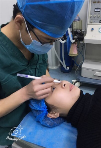 太原时光整形美容医院张国军硅胶隆鼻案例价格分享,鼻子变好看对一张脸的改变有多大?