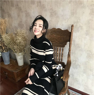 重庆铂生杜亚旭面部填充案例价格分享,做完之后她成为了平面模特~