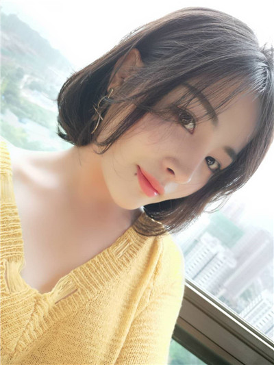 重庆铂生杜亚旭面部填充案例价格分享,做完之后她成为了平面模特~