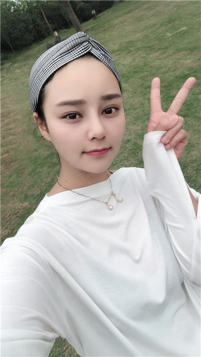 杭州格莱美张龙鼻部手术案例价格分享,现在的鼻子自然又漂亮~