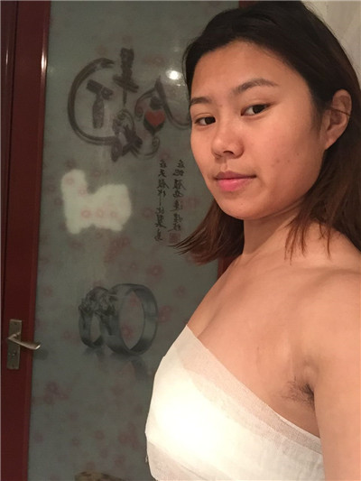 上海仁爱杨苓山隆胸分享,现在姐妹都羡慕我美貌身材又有料!
