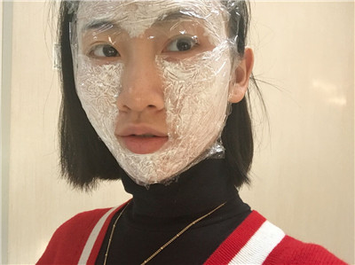 北京伟力嘉美信叶文珏埋线提升案例价格分享,做完竟然皮肤越来越好了~~