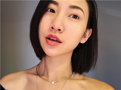 北京伟力嘉美信叶文珏埋线提升案例价格分享,做完竟然皮肤越来越好了~~