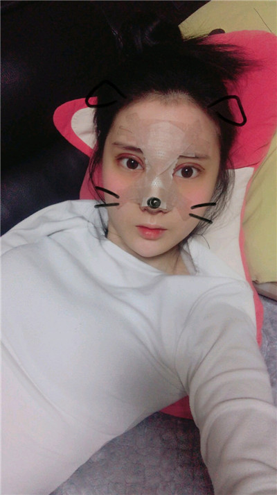 韩国 POP金东杰鼻部手术案例价格分享,这是我见过较自然的鼻子!