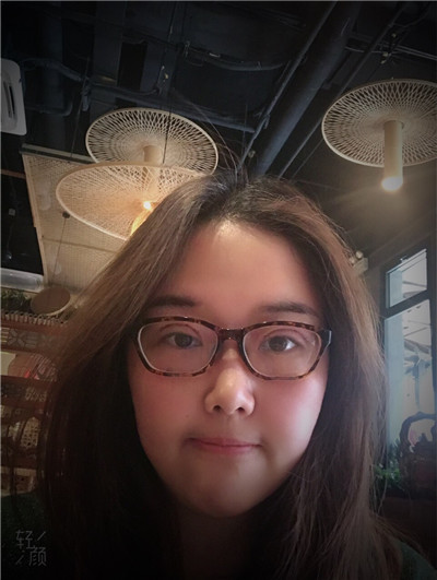 上海九院张盈帆双眼皮案例价格分享,做完全切竟然连疤痕都看不见!