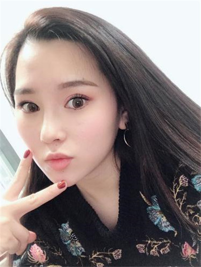 上海九院张盈帆鼻部手术案例价格分享,做完31岁阿姨竟然有小伙子搭讪了!