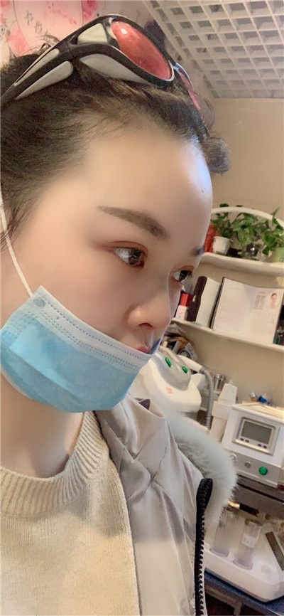 上海九院陈付国鼻部手术案例价格分享,做了鼻子桃花太旺怎么办!