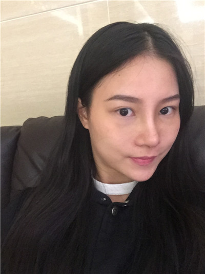 北京柏丽李劲良鼻部手术脂肪填充案例价格分享,这个小姐姐的侧颜杀真的绝了!