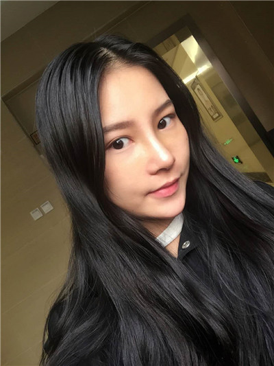 北京柏丽李劲良鼻部手术脂肪填充案例价格分享,这个小姐姐的侧颜杀真的绝了!