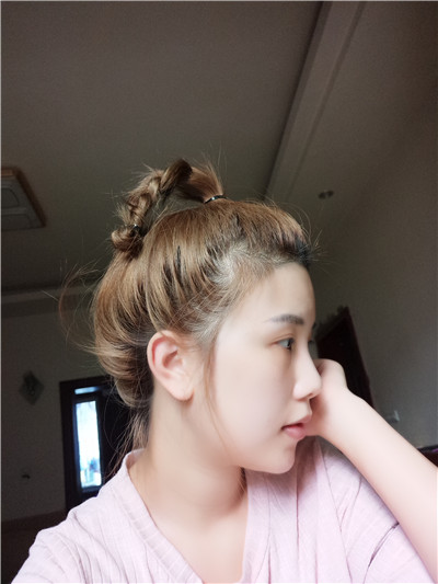 重庆铂生杜亚旭面部填充案例价格分享,我真的不是网红脸!