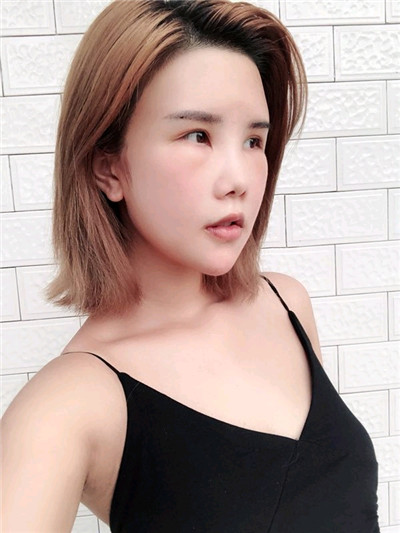 重庆铂生杜亚旭面部填充案例价格分享,我真的不是网红脸!