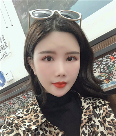 重庆铂生杜亚旭面部填充案例价格分享,我真的不是网红脸!