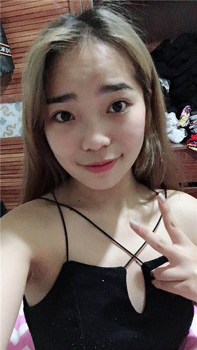 北京八大处刘暾肋软骨隆鼻案例价格分享,我的鼻子是小翘鼻里面较自然的~