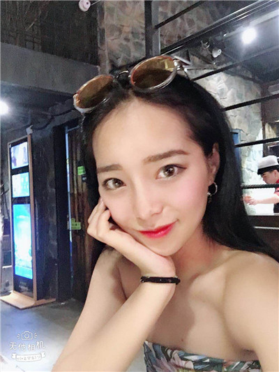 北京八大处刘暾肋软骨隆鼻案例价格分享,我的鼻子是小翘鼻里面较自然的~